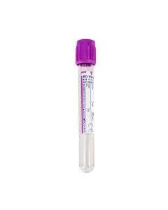 Test tube 100 